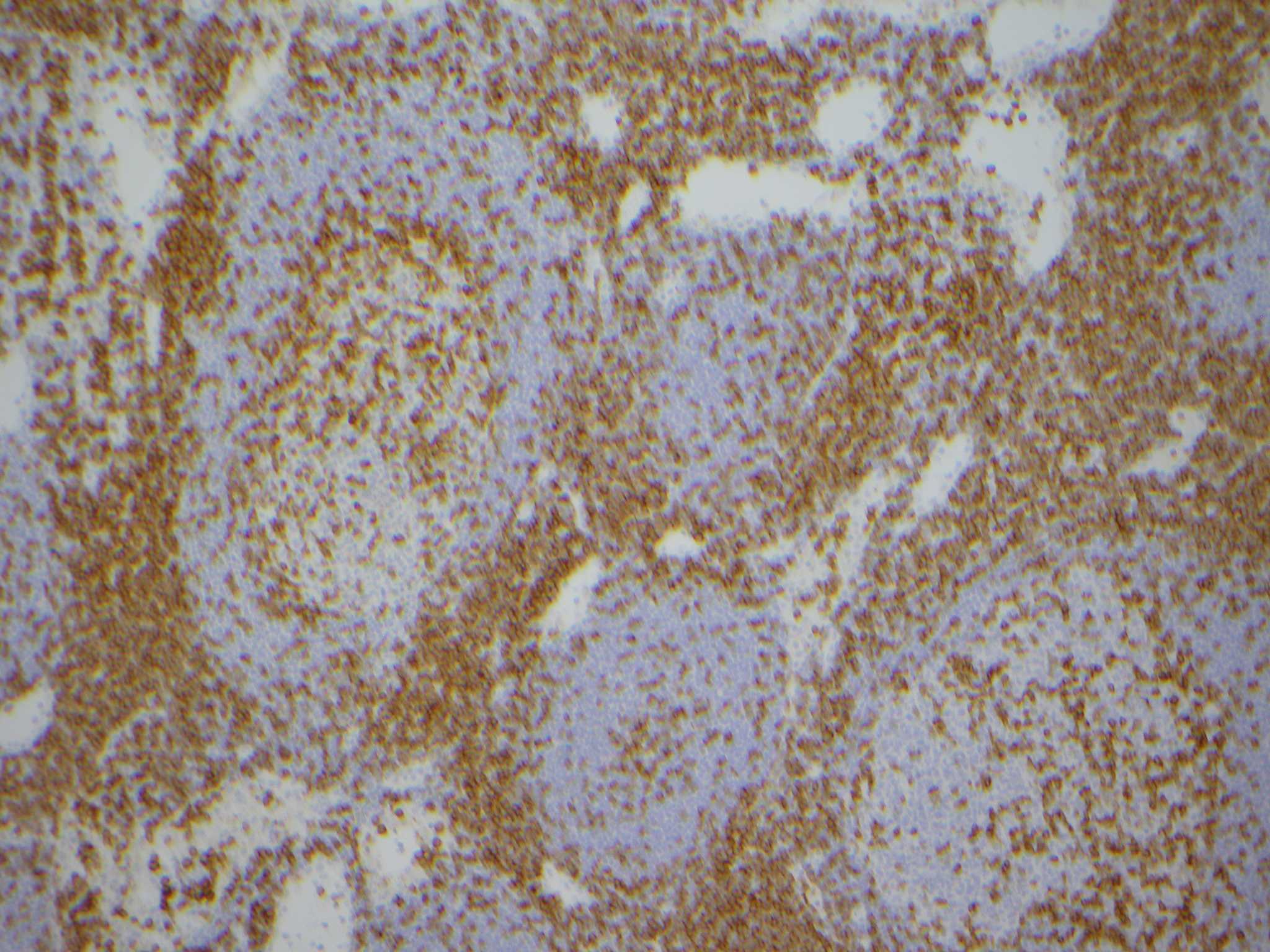 Anatomy of the Immune System – Pathologia