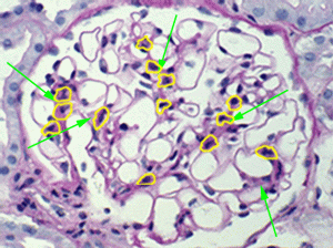 Mesangial cells and mesangium